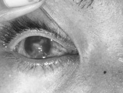 Ada Perbedaan Nominal, Program BKBK Melalui BPJS BPU di Provinsi Jambi Diduga Sarat Akan Korupsi